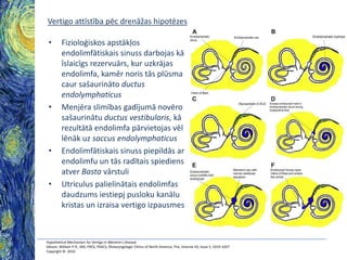 Vertigo attīstība pēc drenāžas hipotēzes
•

•

•

•

Fizioloģiskos apstākļos
endolimfātiskais sinuss darbojas kā
īslaicīgs rezervuārs, kur uzkrājas
endolimfa, kamēr noris tās plūsma
caur sašaurināto ductus
endolymphaticus
Menjēra slimības gadījumā novēro
sašaurinātu ductus vestibularis, kā
rezultātā endolimfa pārvietojas vēl
lēnāk uz saccus endolymphaticus
Endolimfātiskais sinuss piepildās ar
endolimfu un tās radītais spiediens
atver Basta vārstuli
Utriculus palielinātais endolimfas
daudzums iestiepj pusloku kanālu
kristas un izraisa vertigo izpausmes

Hypothetical Mechanism for Vertigo in Meniere's Disease
Gibson, William P.R., MD, FRCS, FRACS, Otolaryngologic Clinics of North America, The, Volume 43, Issue 5, 1019-1027
Copyright © 2010

 