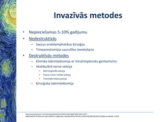 Invazīvās metodes
• Nepieciešamas 5-10% gadījumu
• Nedestruktīvās
– Saccus endolymphatikus ķirurģija
– Timpanostomijas caurulītes ievietošana

• Destruktīvās metodes
– Ķīmiska labrintektomija ar intratimpānisku gentamicīnu
– Vestibulārā nerva sekcija
•
•
•

Retrosigmāla pieeja
Fossa cranii media pieeja
Translabrintāra pieeja

– Ķirurģiska labrintektomija

http://web.ebscohost.com/dynamed/detail?vid=3&sid=0da1780b-006b-481d-b447a0681d481813%40sessionmgr110&hid=118&bdata=JnNpdGU9ZHluYW1lZC1saXZlJnNjb3BlPXNpdGU%3d#db=dme&AN=113932

 