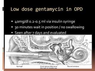 Low dose gentamycin in OPD
 40mg/dl 0.2-0.5 ml via insulin syringe
 30 minutes wait in position / no swallowing
 Seen after 7 days and evaluated
 