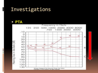 Investigations
 PTA
 