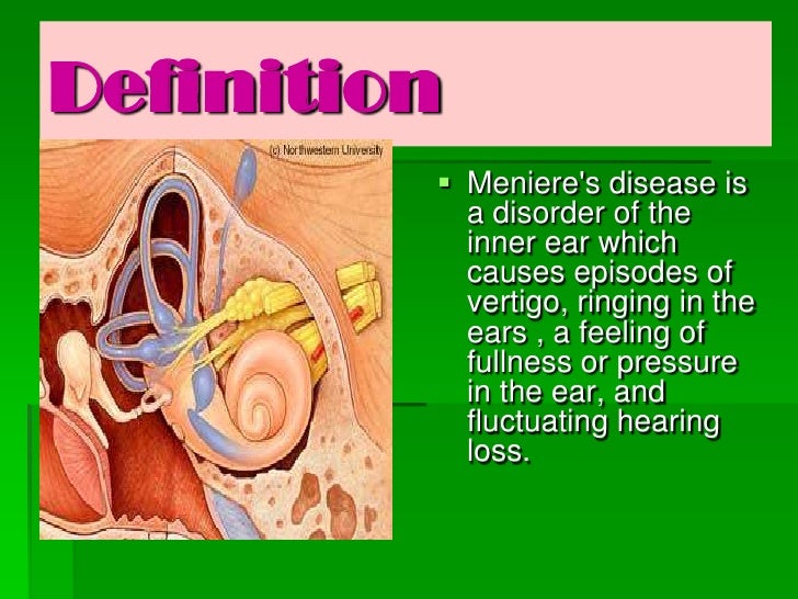 Meniere’s disease