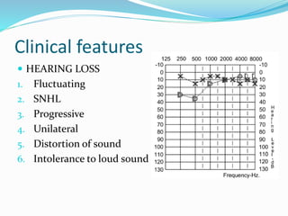Clinical features
 HEARING LOSS
1. Fluctuating
2. SNHL
3. Progressive
4. Unilateral
5. Distortion of sound
6. Intolerance to loud sound
 