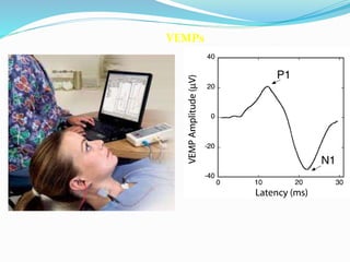VEMPs
 