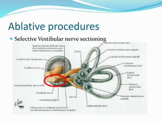 Ablative procedures
 Selective Vestibular nerve sectioning
 