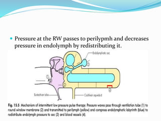  Pressure at the RW passes to perilypmh and decreases
pressure in endolymph by redistributing it.
 
