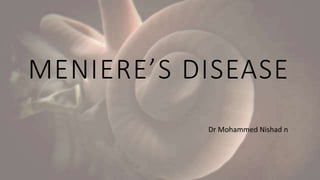 MENIERE’S DISEASE
Dr Mohammed Nishad n
 