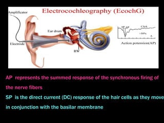 AP represents the summed response of the synchronous firing of
the nerve fibers
SP is the direct current (DC) response of the hair cells as they move
in conjunction with the basilar membrane
 
