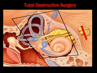 Total Destructive Surgery
 