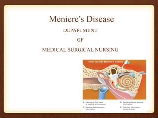 Meniere’s Disease
DEPARTMENT
OF
MEDICAL SURGICAL NURSING
 