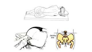 Meningeal syndrome.pptx for medical students | PPT