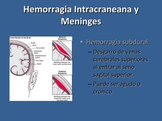 Hemorragia Intracraneana y Meninges Hemorragia subdural: Desgarro de venas cerebrales superiores al entrar al seno sagital superior. Puede ser agudo o crónico. 