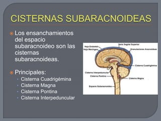    Los ensanchamientos
    del espacio
    subaracnoideo son las
    cisternas
    subaracnoideas.

   Principales:
    •   Cisterna Cuadrigémina
    •   Cisterna Magna
    •   Cisterna Pontina
    •   Cisterna Interpeduncular
 