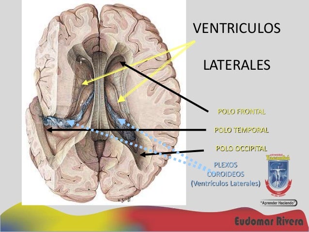 Resultado de imagen para plexos coroideos de los ventriculos