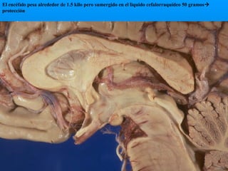 El encéfalo pesa alrededor de 1.5 kilo pero sumergido en el liquido cefalorraquídeo 50 gramos
protección

 