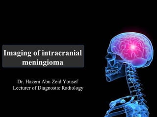 Imaging of intracranial
meningioma
Dr. Hazem Abu Zeid Yousef
Lecturer of Diagnostic Radiology
 
