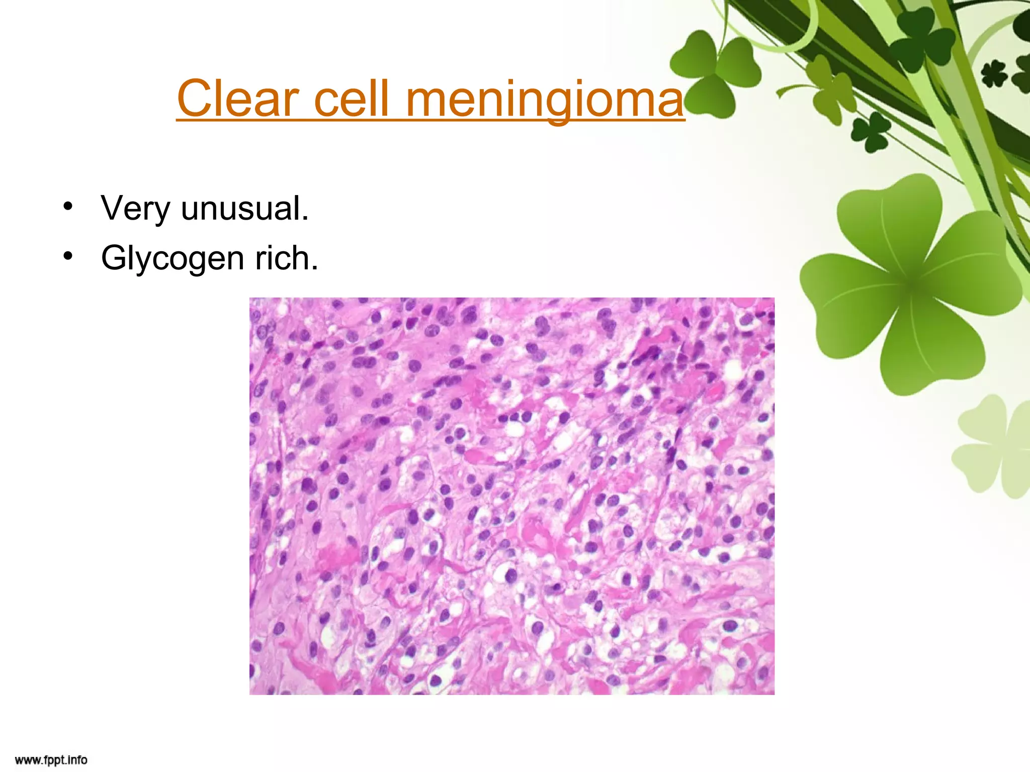 Clear cell meningioma
• Very unusual.
• Glycogen rich.
