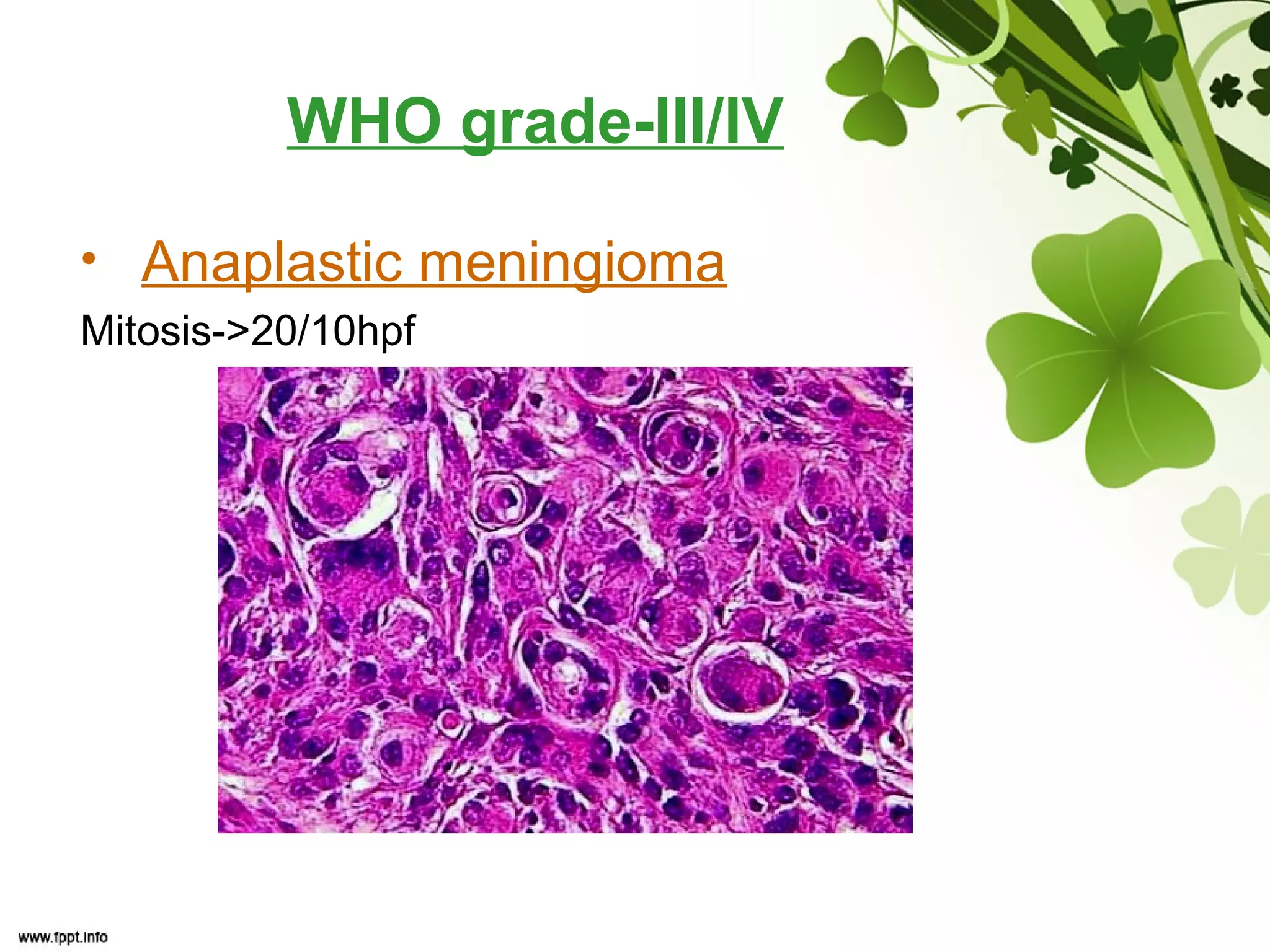 WHO grade-III/IV
• Anaplastic meningioma
Mitosis->20/10hpf