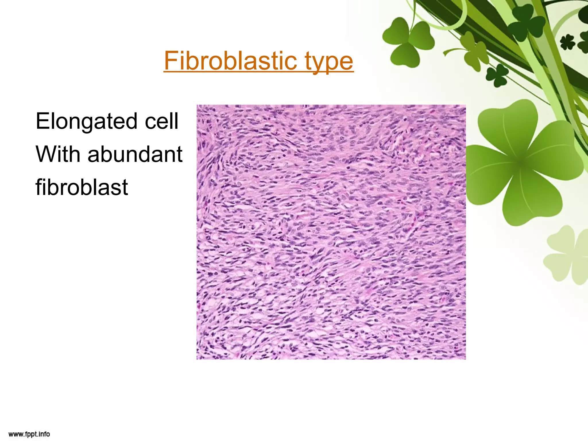 Fibroblastic type
Elongated cell
With abundant
fibroblast