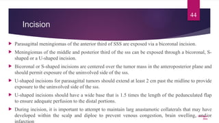 Sss Infarction Comprehensive Overview of Falcine and Parasagittal Meningiomas ...