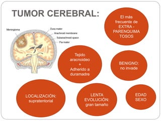 TUMOR CEREBRAL: El más
frecuente de
EXTRA -
PARENQUIMA
TOSOS
Tejido
aracnoideo
+
Adherido a
duramadre
BENIGNO:
no invade
LENTA
EVOLUCIÓN:
gran tamaño
LOCALIZACIÓN:
supratentorial
EDAD
SEXO
 