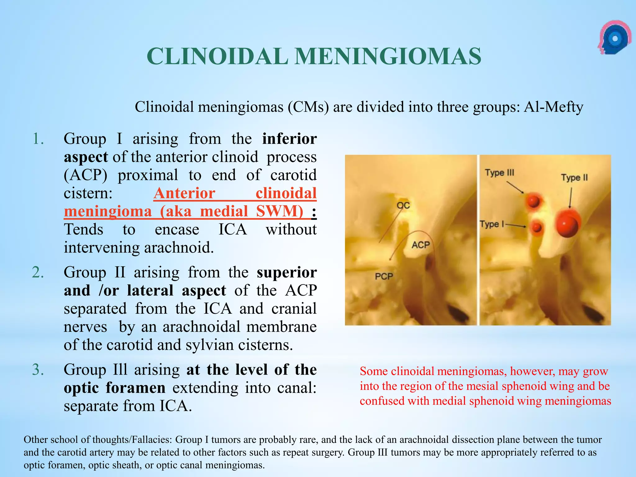 Meningioma of brain | PPTX