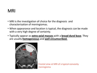 MRI
• MRI is the investigation of choice for the diagnosis and
characterization of meningiomas.
• When appearance and location is typical, the diagnosis can be made
with a very high degree of certainty.
• Typically appear as extra-axial masses with a broad dural base. They
are usually homogeneous and well circumscribed.
Frontal view at MRI of a typical convexity
meningioma
 