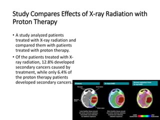 Study Compares Effects of X-ray Radiation with
Proton Therapy
• A study analyzed patients
treated with X-ray radiation and
compared them with patients
treated with proton therapy.
• Of the patients treated with X-
ray radiation, 12.8% developed
secondary cancers caused by
treatment, while only 6.4% of
the proton therapy patients
developed secondary cancers.
 