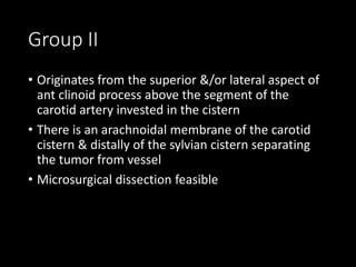 Group II
• Originates from the superior &/or lateral aspect of
ant clinoid process above the segment of the
carotid artery invested in the cistern
• There is an arachnoidal membrane of the carotid
cistern & distally of the sylvian cistern separating
the tumor from vessel
• Microsurgical dissection feasible
 