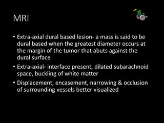 MRI
• Extra-axial dural based lesion- a mass is said to be
dural based when the greatest diameter occurs at
the margin of the tumor that abuts against the
dural surface
• Extra-axial- interface present, dilated subarachnoid
space, buckling of white matter
• Displacement, encasement, narrowing & occlusion
of surrounding vessels better visualized
 