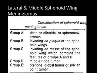 Lateral & Middle Sphenoid Wing
Meningiomas
 