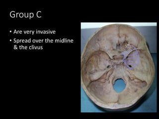 Group C
• Are very invasive
• Spread over the midline
& the clivus
 