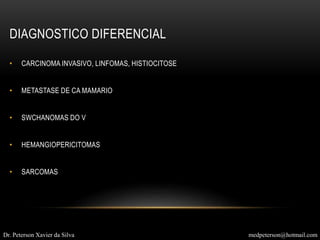 • CARCINOMA INVASIVO, LINFOMAS, HISTIOCITOSE
• METASTASE DE CA MAMARIO
• SWCHANOMAS DO V
• HEMANGIOPERICITOMAS
• SARCOMAS
DIAGNOSTICO DIFERENCIAL
Dr. Peterson Xavier da Silva medpeterson@hotmail.com
 