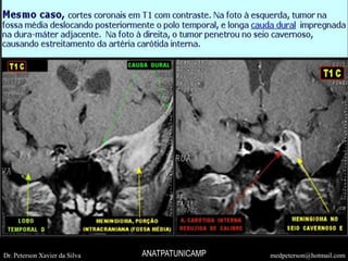 Dr. Peterson Xavier da Silva medpeterson@hotmail.comANATPATUNICAMP
 