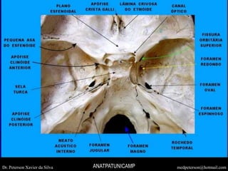 Dr. Peterson Xavier da Silva medpeterson@hotmail.comANATPATUNICAMP
 