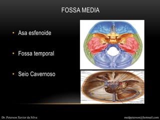 FOSSA MEDIA
• Asa esfenoide
• Fossa temporal
• Seio Cavernoso
Dr. Peterson Xavier da Silva medpeterson@hotmail.com
 