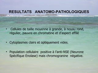 RESULTATS  ANATOMO-PATHOLOGIQUES Cellules de taille moyenne à grande, à noyau rond, régulier, pauvre en chromatine et d’aspect effilé Cytoplasmes clairs et optiquement vides. Population cellulaire  positive à l’anti-NSE (Neurone Spécifique Enolase) mais chromogranine  négative. 
