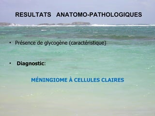 RESULTATS  ANATOMO-PATHOLOGIQUES  <ul><li>Présence de glycogène (caractéristique) </li></ul><ul><li>Diagnostic :  </li></u...