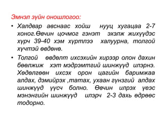 Эмнэл зүйн оношлогоо: 
• Халдвар авснаас хойш нууц хугацаа 2-7 
хоног.Өвчин цочмог гэнэт эхэлж жихүүдэс 
хүрч 39-40 хэм хүртлээ халуурна, толгой 
хүчтэй өвдөнө. 
• Толгой өвдөлт ихсэхийн хирээр олон дахин 
бөөлжиж хэт мэдрэмтгий шинжүүд илэрнэ. 
Хөдөлгөөн ихсэх орон цагийн баримжаа 
алдах, дэмийрэх ,татах, ухаан гүнзгий алдах 
шинжүүд үүсч болно. Өвчин илрэх үеэс 
мэнэнгийн шинжүүд илэрч 2-3 дахь өдрөөс 
тодорно. 
 