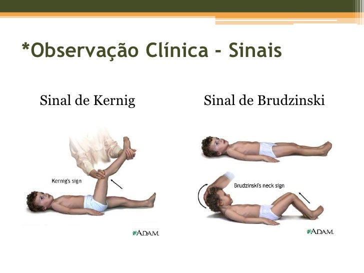 Exame meningite