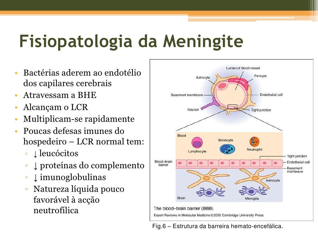 Meningite Meningite