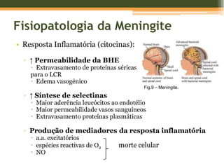 *Observação Clínica - Sinais    Sinal de Kernig		Sinal de Brudzinski