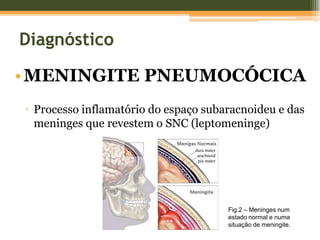 Hematócrito		35%		  (36±5)