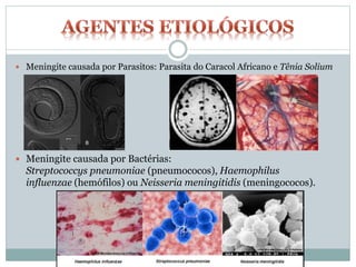  Meningite causada por Parasitos: Parasita do Caracol Africano e Tênia Solium
 Meningite causada por Bactérias:
Streptococcys pneumoniae (pneumococos), Haemophilus
influenzae (hemófilos) ou Neisseria meningitidis (meningococos).
 