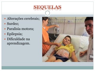  Alterações cerebrais;
 Surdez;
 Paralisia motora;
 Epilepsia;
 Dificuldade na
aprendizagem.
 