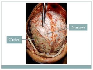 Meninges
Cérebro
 