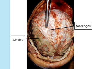 Meninges
Cérebro
 