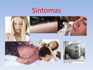 Sintomas
 