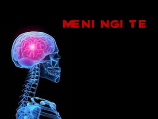 MENINGITE 