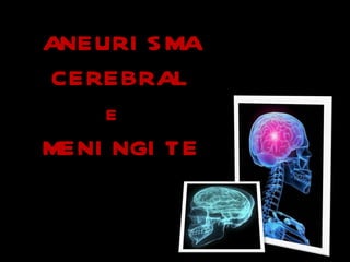 ANEURISMA CEREBRAL E   MENINGITE 