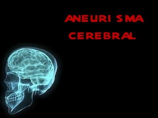 ANEURISMA CEREBRAL 